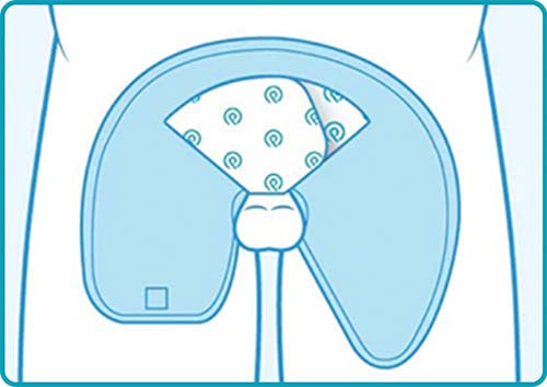 Standard Penis – Strong Urine Flow Application Instructions